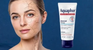 Read more about the article Aquaphor Skincare Ointment for Radiation Therapy