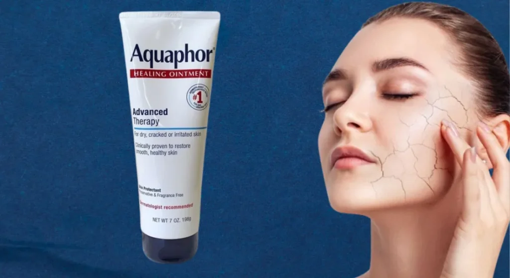 Aquaphor skincare ointment 